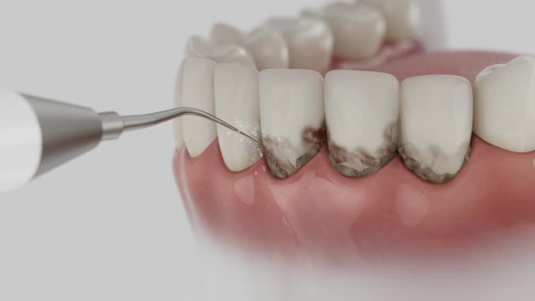 Trusted Root Canal Treatment service in Fallston, MD - Dentist Open Now